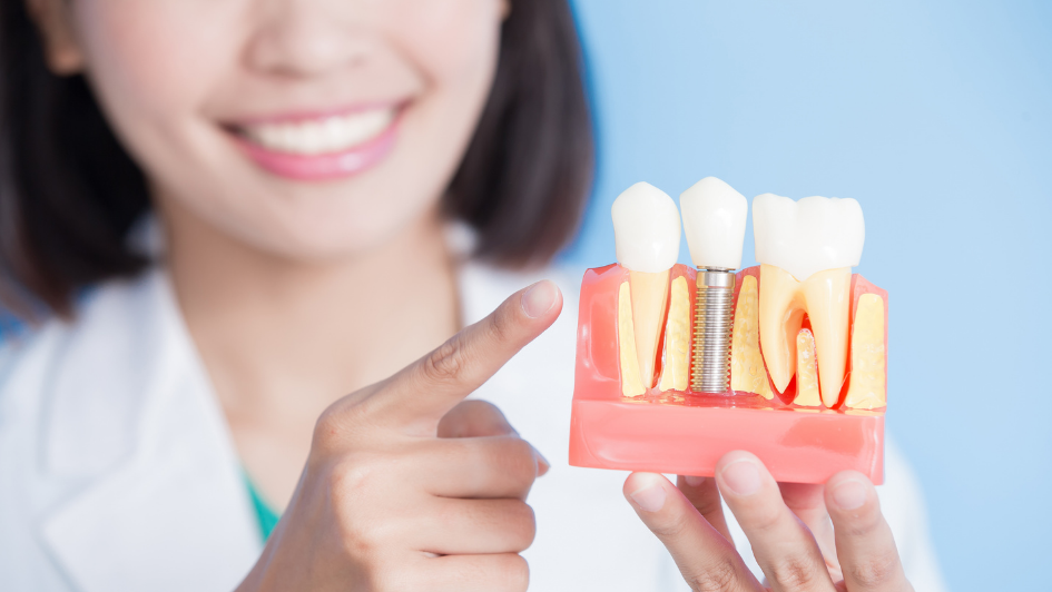 Read more about the article Viêm tủy răng: Thông tin đầy đủ về chi phí và phương pháp điều trị