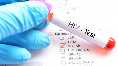 You are currently viewing HIV xâm nhập vào cơ thể gây chết người ra sao? Các giai đoạn của bệnh HIV/AIDS như thế nào?