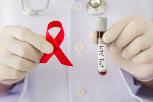 Read more about the article Các dấu hiệu, biểu hiện và triệu chứng của bệnh HIV/AIDS